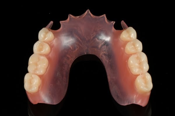 flexible partial denture