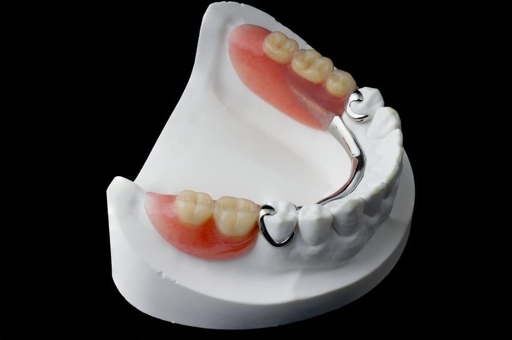 partial dentures