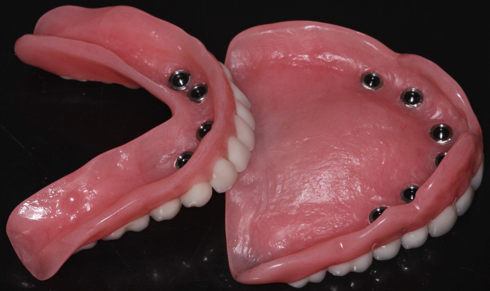 implant dentures